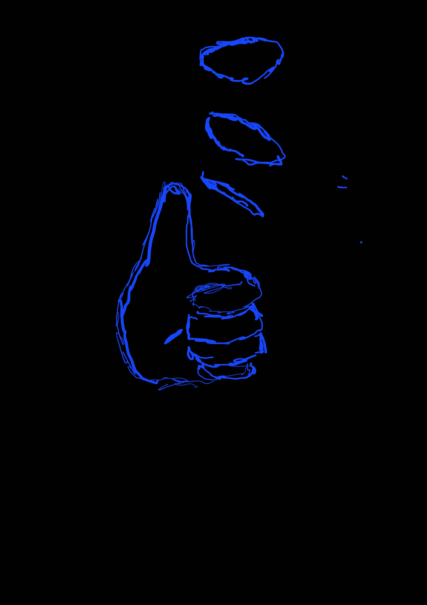 the medical code for measels